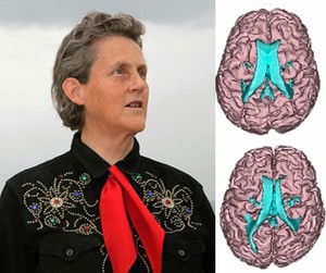 Temple-Grandin-brain.jpg